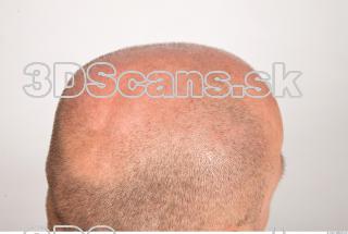 Hair texture of Dale 0004